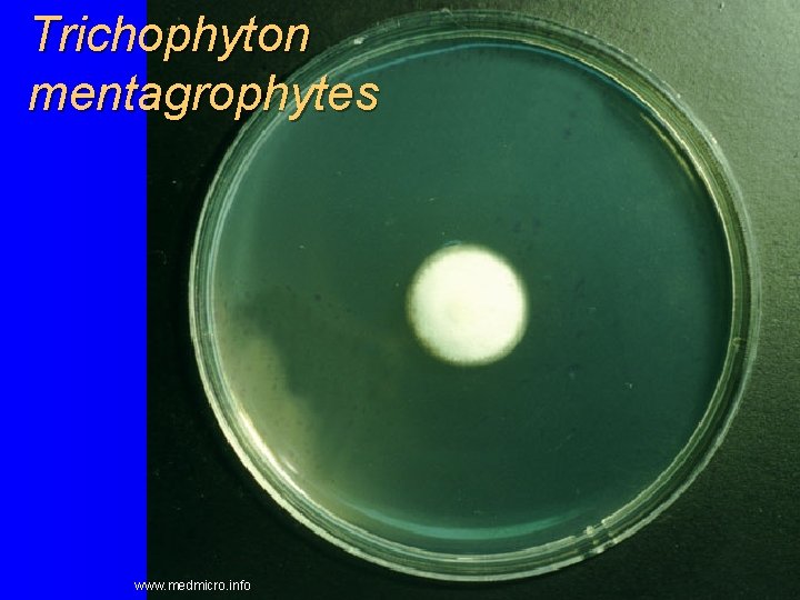 Trichophyton mentagrophytes www. medmicro. info 