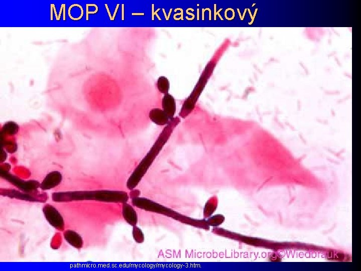 MOP VI – kvasinkový pathmicro. med. sc. edu/mycology-3. htm. 