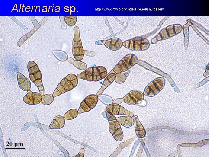 Alternaria sp. http: //www. mycology. adelaide. edu. au/gallery 