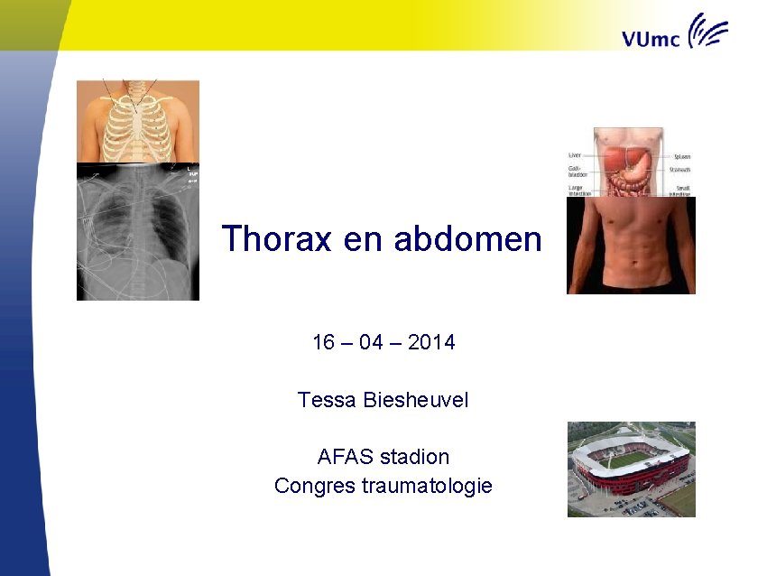 Thorax en abdomen 16 – 04 – 2014 Tessa Biesheuvel AFAS stadion Congres traumatologie