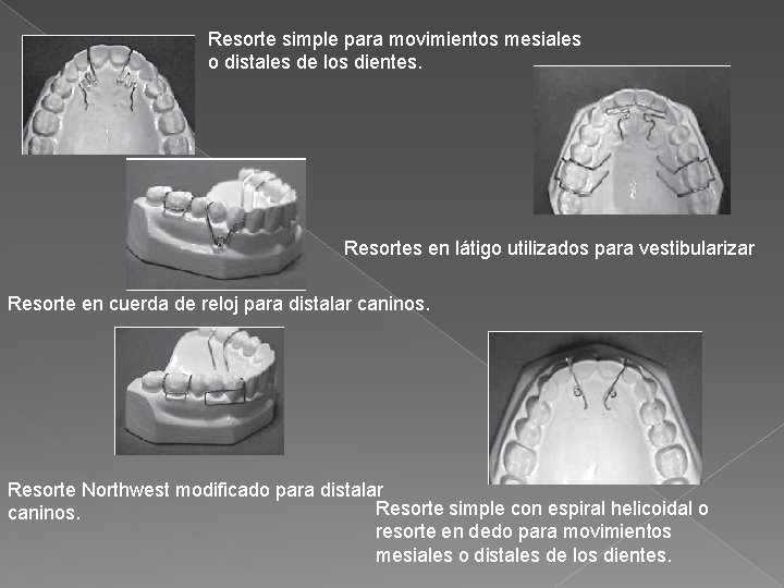 Resorte simple para movimientos mesiales o distales de los dientes. Resortes en látigo utilizados Resorte simple para movimientos mesiales o distales de los dientes. Resortes en látigo utilizados