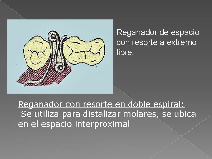 Reganador de espacio con resorte a extremo libre. Reganador con resorte en doble espiral: Reganador de espacio con resorte a extremo libre. Reganador con resorte en doble espiral: