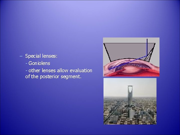 – Special lenses: - Goniolens - other lenses allow evaluation of the posterior segment.