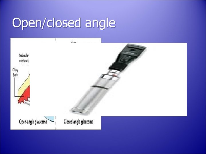 Open/closed angle 