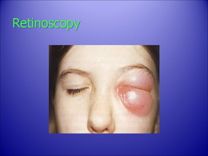 Retinoscopy 