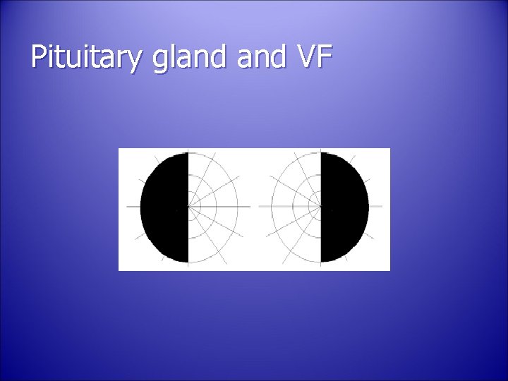 Pituitary gland VF 