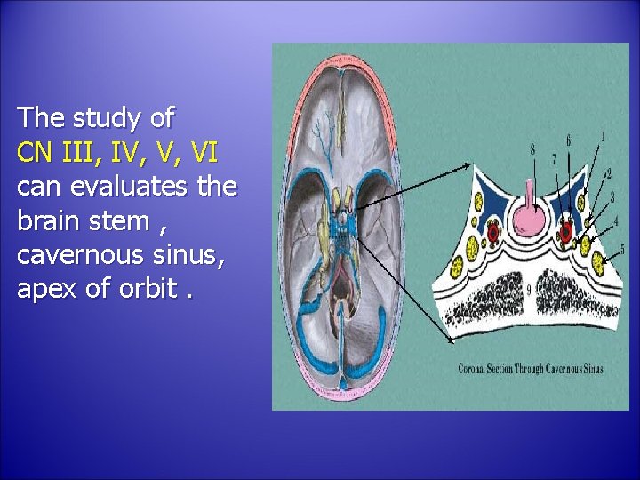 The study of CN III, IV, V, VI can evaluates the brain stem ,