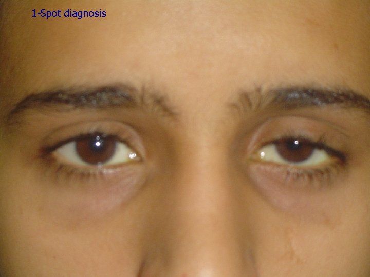 1 -Spot diagnosis 