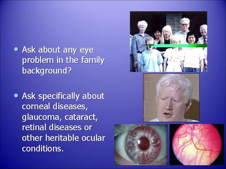  • Ask about any eye problem in the family background? • Ask specifically