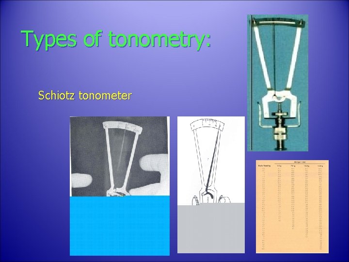 Types of tonometry: Schiotz tonometer 