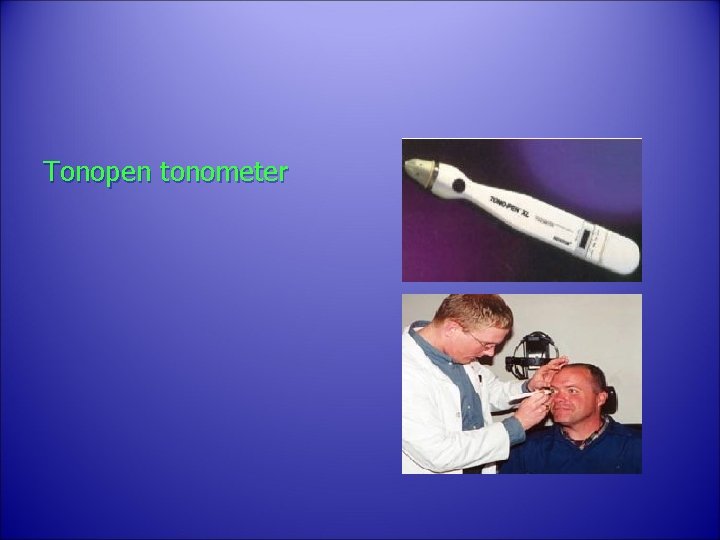 Tonopen tonometer 