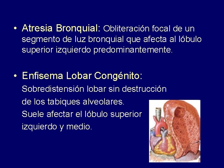  • Atresia Bronquial: Obliteración focal de un segmento de luz bronquial que afecta
