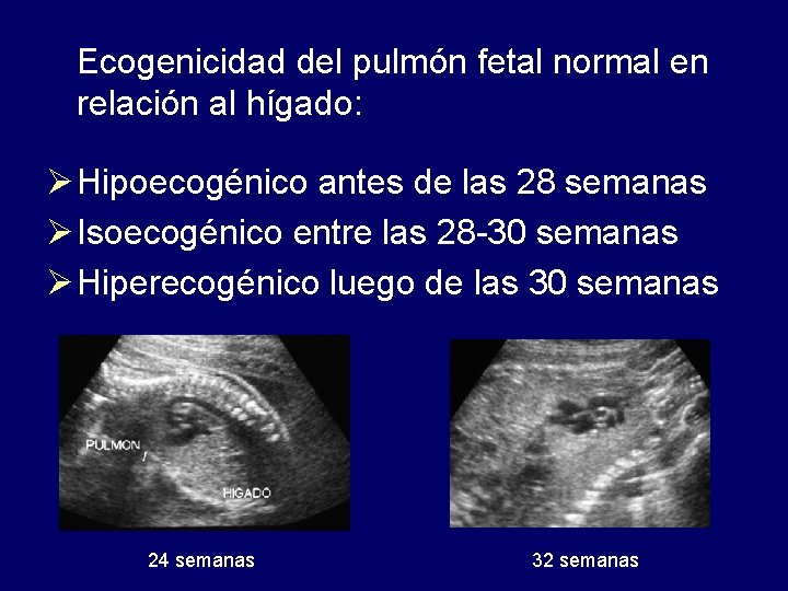  Ecogenicidad del pulmón fetal normal en relación al hígado: Ø Hipoecogénico antes de