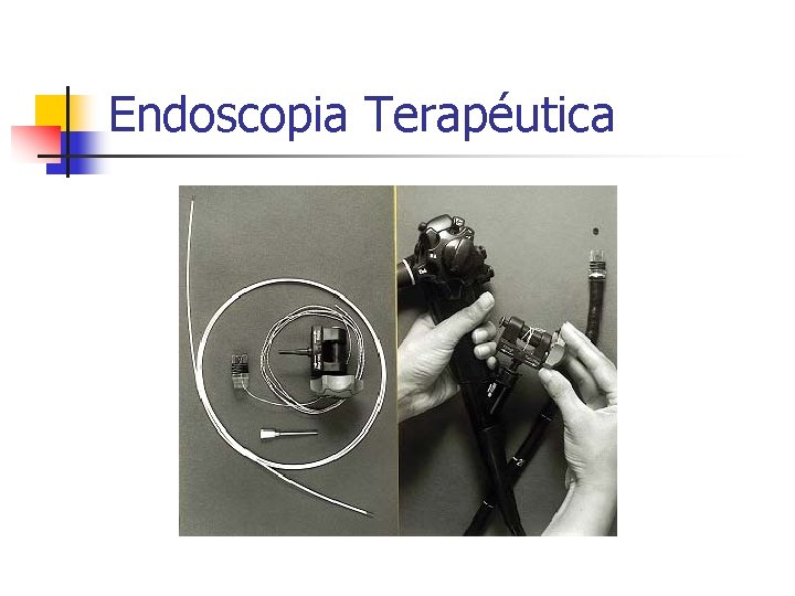 Endoscopia Terapéutica 