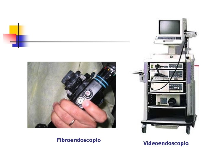 Fibroendoscopio Videoendoscopio 