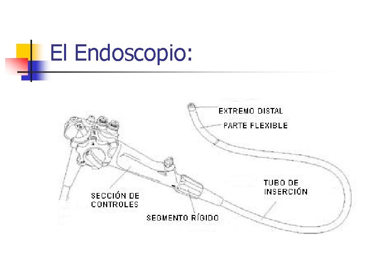 El Endoscopio: 