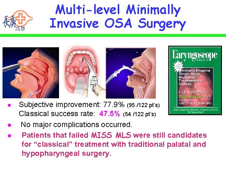 Multi-level Minimally Invasive OSA Surgery l l l Subjective improvement: 77. 9% (95 /122