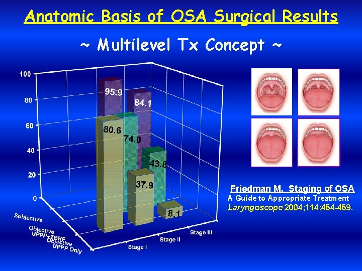 Anatomic Basis of OSA Surgical Results ~ Multilevel Tx Concept ~ Friedman M. Staging