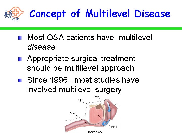 Concept of Multilevel Disease Most OSA patients have multilevel disease Appropriate surgical treatment should