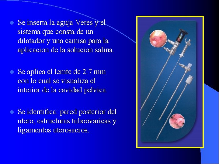 l Se inserta la aguja Veres y el sistema que consta de un dilatador