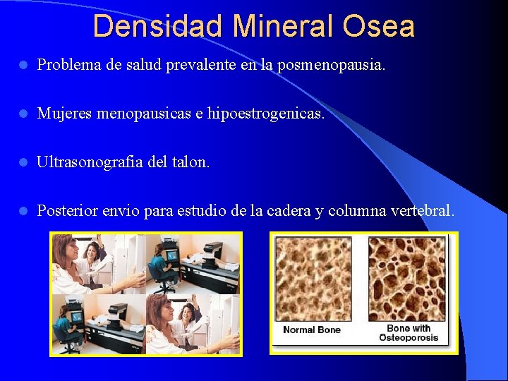 Densidad Mineral Osea l Problema de salud prevalente en la posmenopausia. l Mujeres menopausicas