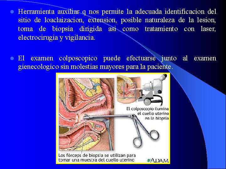 l Herramienta auxiliar q nos permite la adecuada identificacion del sitio de loaclaizacion, extension,