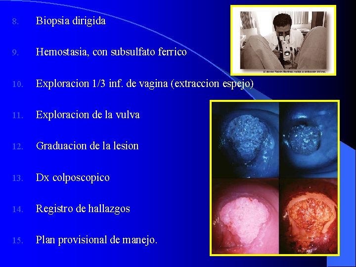 8. Biopsia dirigida 9. Hemostasia, con subsulfato ferrico 10. Exploracion 1/3 inf. de vagina