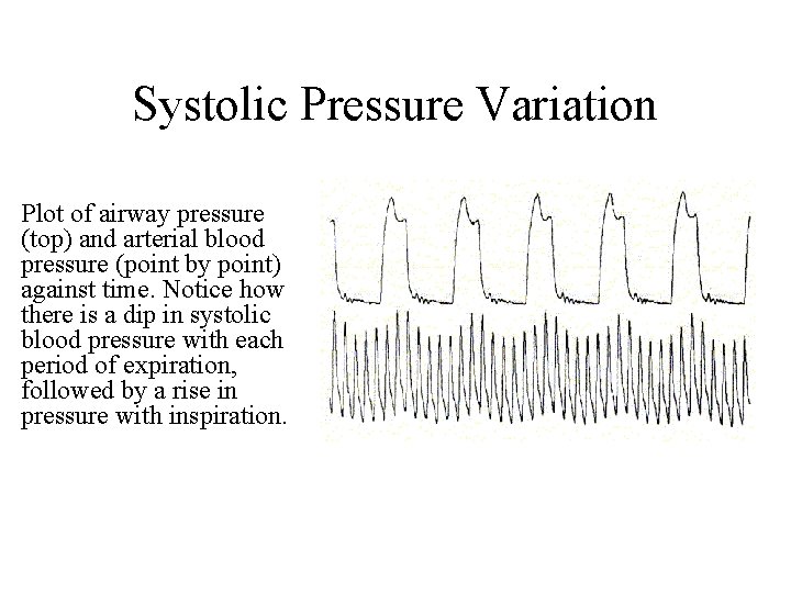 Systolic Pressure Variation Plot of airway pressure (top) and arterial blood pressure (point by