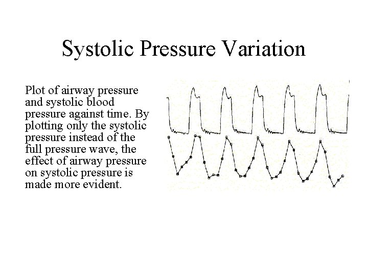 Systolic Pressure Variation Plot of airway pressure and systolic blood pressure against time. By