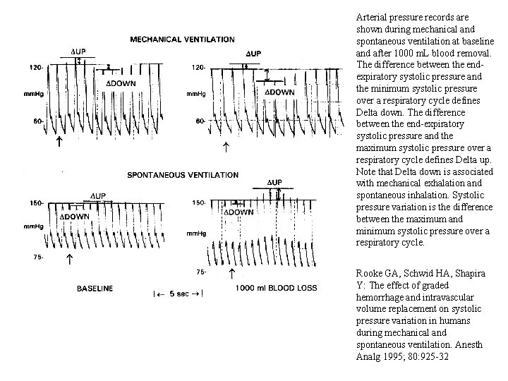 Arterial pressure records are shown during mechanical and spontaneous ventilation at baseline and after