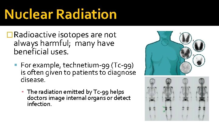 Nuclear Radiation � Radioactive isotopes are not always harmful; many have beneficial uses. For Nuclear Radiation � Radioactive isotopes are not always harmful; many have beneficial uses. For