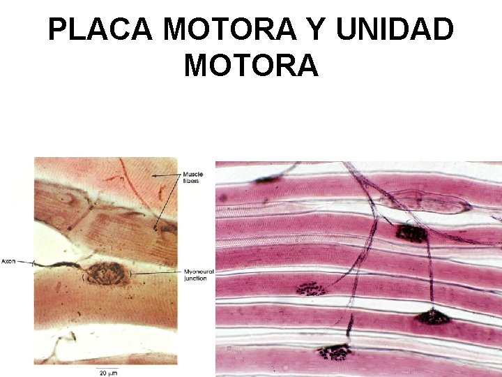 PLACA MOTORA Y UNIDAD MOTORA 12/1/2020 25 