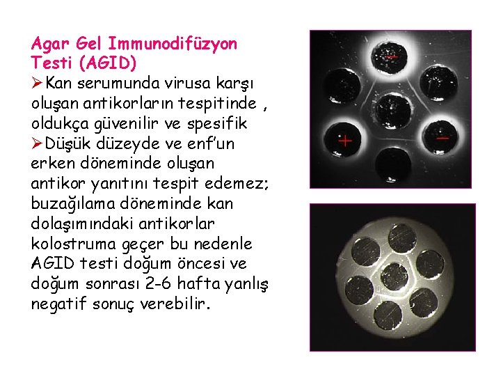 Agar Gel Immunodifüzyon Testi (AGID) ØKan serumunda virusa karşı oluşan antikorların tespitinde , oldukça