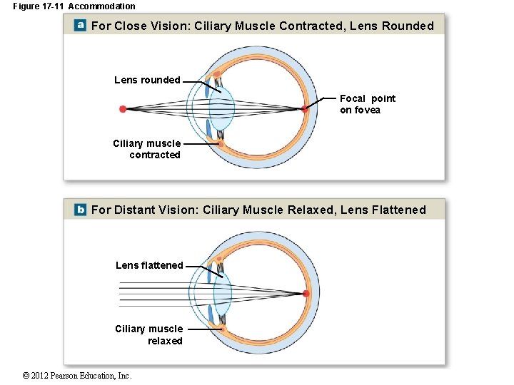 Figure 17 -11 Accommodation For Close Vision: Ciliary Muscle Contracted, Lens Rounded Lens rounded