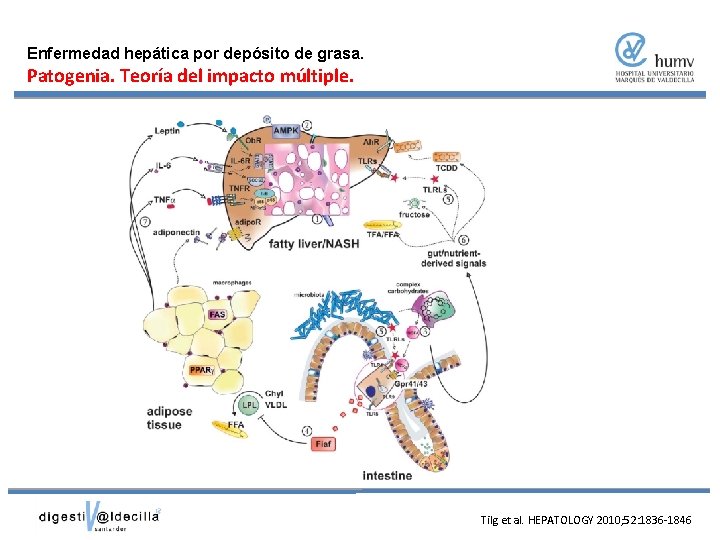 Enfermedad hepática por depósito de grasa. Patogenia. Teoría del impacto múltiple. Tilg et al.