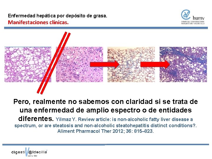 Enfermedad hepática por depósito de grasa. Manifestaciones clínicas. Pero, realmente no sabemos con claridad