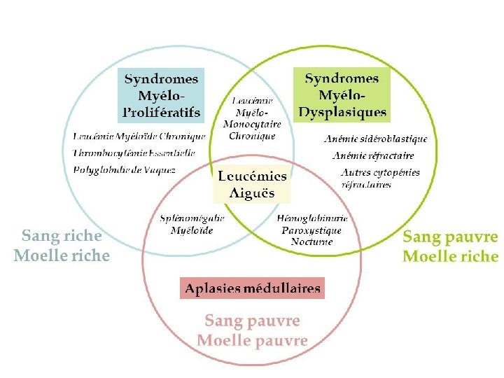 IV- LES HEMOPATHIES MALIGNES Moelle osseuse Sang Myélodysplasie, LA, PNN Myélome, LLC, Waldenström, PNE IV- LES HEMOPATHIES MALIGNES Moelle osseuse Sang Myélodysplasie, LA, PNN Myélome, LLC, Waldenström, PNE