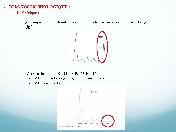 - DIAGNOSTIC BIOLOGIQUE : - Ed. P sérique : - gammapathie monoclonale = pic - DIAGNOSTIC BIOLOGIQUE : - Ed. P sérique : - gammapathie monoclonale = pic