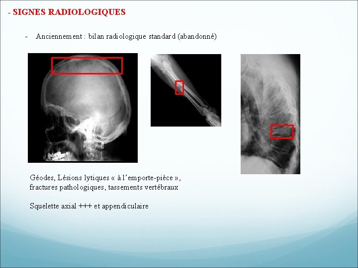 - SIGNES RADIOLOGIQUES - Anciennement : bilan radiologique standard (abandonné) Géodes, Lésions lytiques « - SIGNES RADIOLOGIQUES - Anciennement : bilan radiologique standard (abandonné) Géodes, Lésions lytiques «