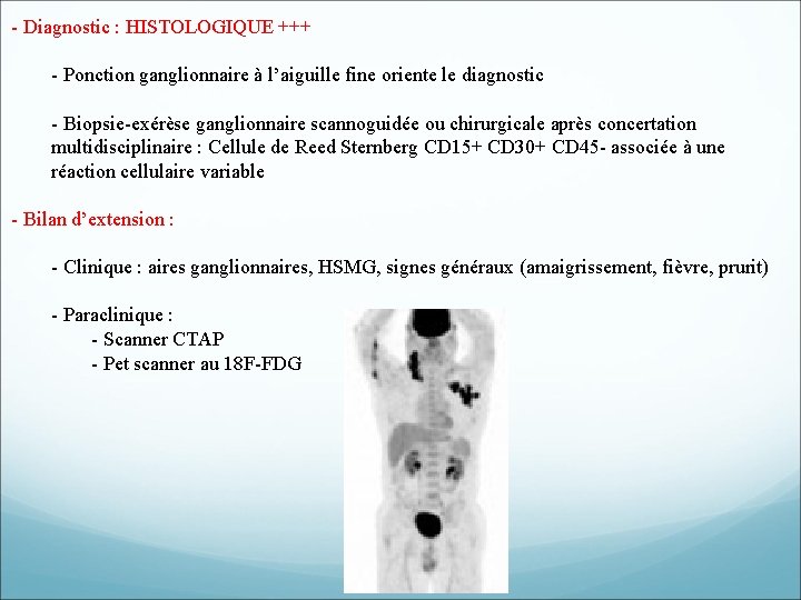- Diagnostic : HISTOLOGIQUE +++ - Ponction ganglionnaire à l’aiguille fine oriente le diagnostic - Diagnostic : HISTOLOGIQUE +++ - Ponction ganglionnaire à l’aiguille fine oriente le diagnostic
