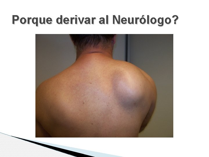 Porque derivar al Neurólogo? Porque derivar al Neurólogo?