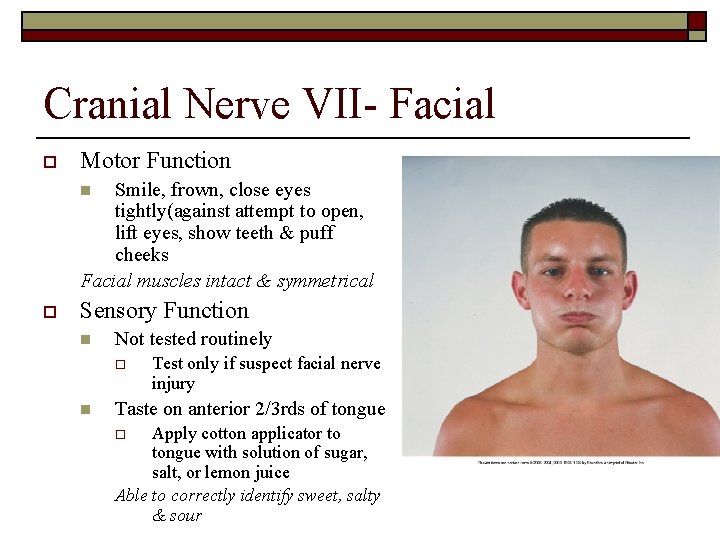 Cranial Nerve VII- Facial o Motor Function Smile, frown, close eyes tightly(against attempt to