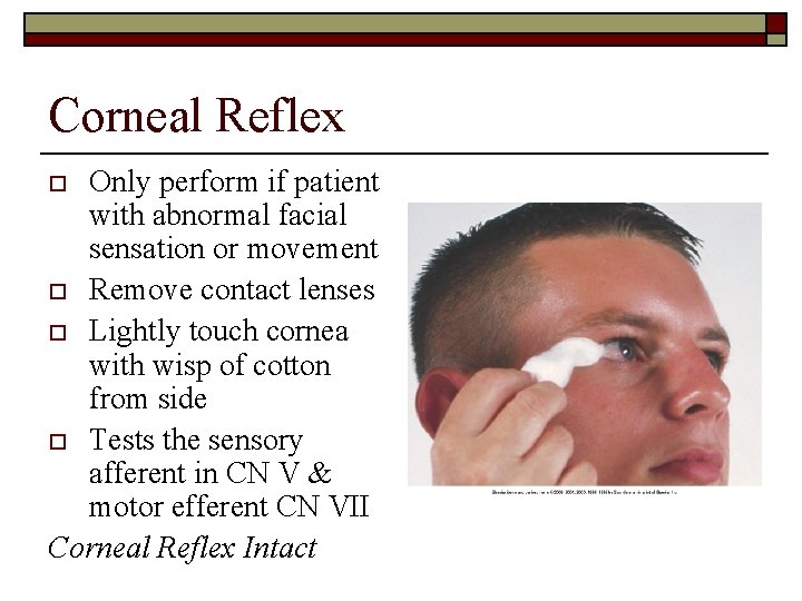 Corneal Reflex Only perform if patient with abnormal facial sensation or movement o Remove