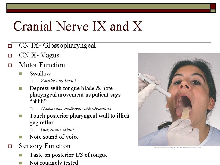 Cranial Nerve IX and X o o o CN IX- Glossopharyngeal CN X- Vagus