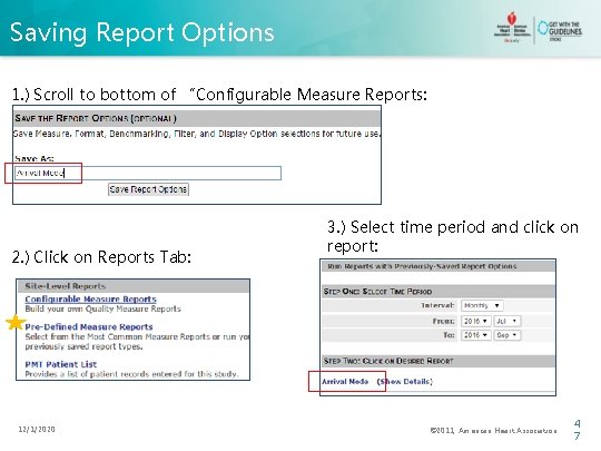 Saving Report Options 1. ) Scroll to bottom of “Configurable Measure Reports: 2. )