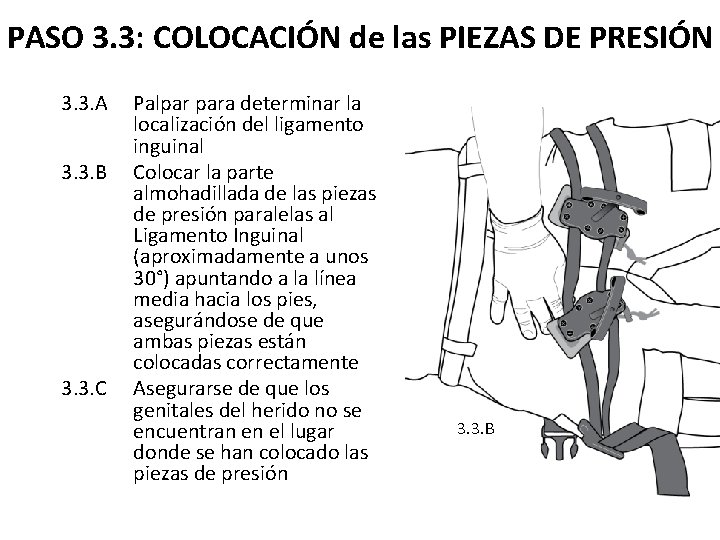 PASO 3. 3: COLOCACIÓN de las PIEZAS DE PRESIÓN 3. 3. A 3. 3.