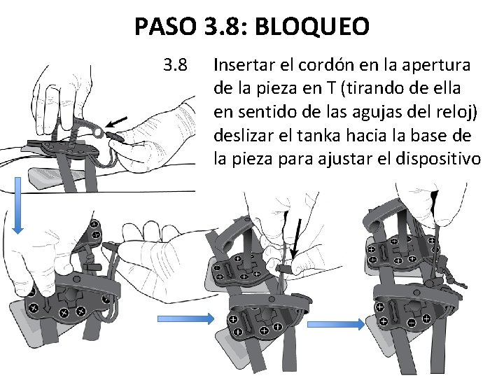 PASO 3. 8: BLOQUEO 3. 8 Insertar el cordón en la apertura de la