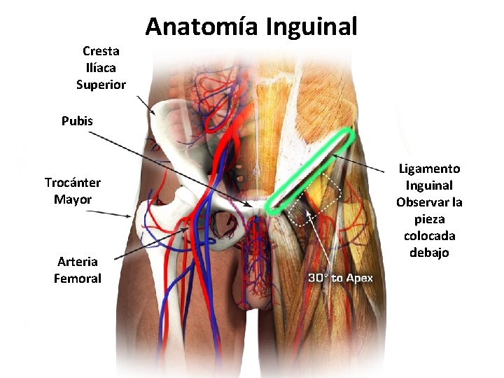 Cresta Ilíaca Superior Anatomía Inguinal Pubis Trocánter Mayor Arteria Femoral Ligamento Inguinal Observar la