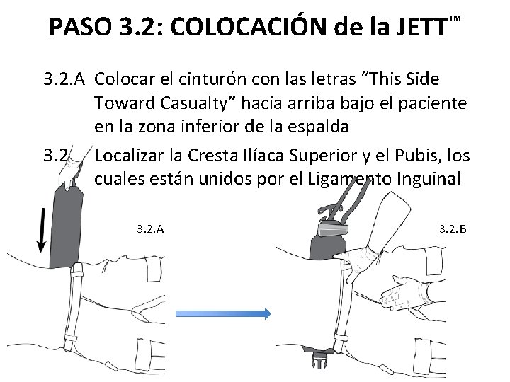 PASO 3. 2: COLOCACIÓN de la JETT™ 3. 2. A Colocar el cinturón con