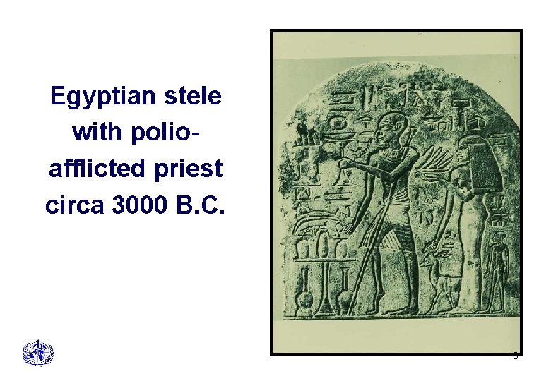 Egyptian stele with polioafflicted priest circa 3000 B. C. Polio Eradication 3 